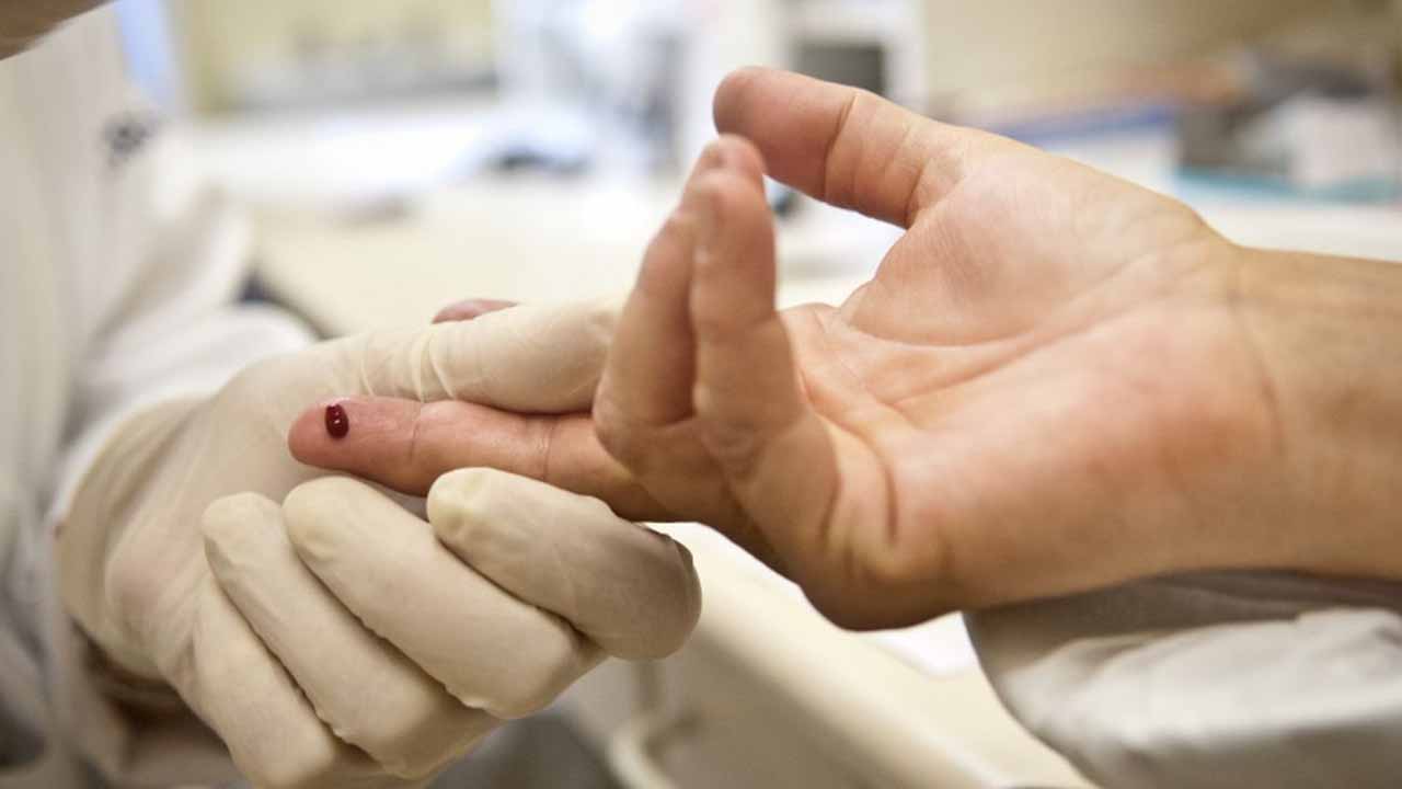 Justiça Proíbe Exigência De Teste Hiv Para Candidatos A Concursos O Rolo Notícias